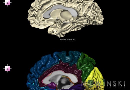 G9.T7.20.DualImageSulci.Rhinal sulcus right