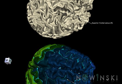 G9.T7.22.DualImageSulci.Superior frontal sulcus right