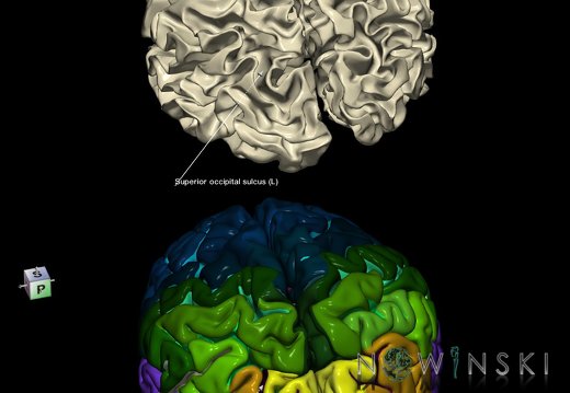 G9.T7.23.DualImageSulci.Superior occipital sulcus left