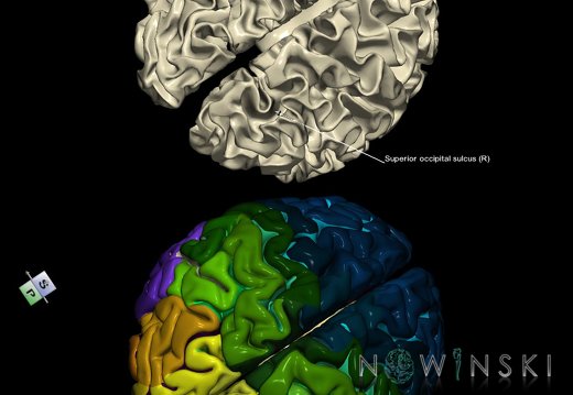G9.T7.23.DualImageSulci.Superior occipital sulcus right