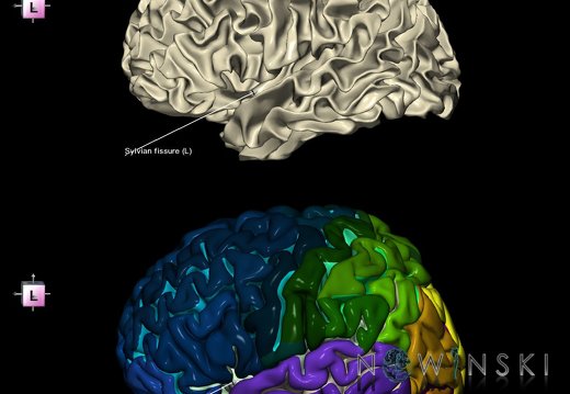 G9.T7.26.DualImageSulci.Sylvian fissure left