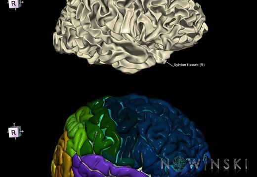 G9.T7.26.DualImageSulci.Sylvian fissure right