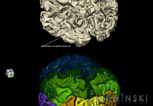 G9.T7.27.DualImageSulci.Transverse occipital sulcus left