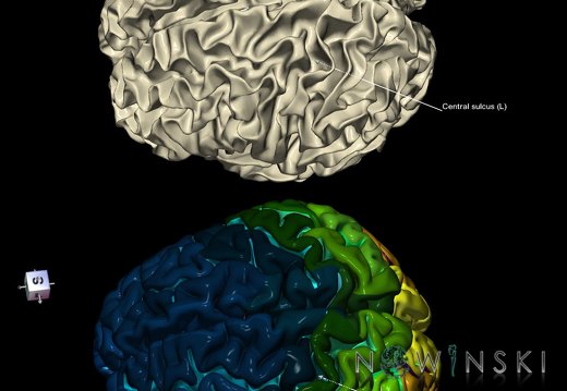 G9.T7.3.DualImageSulci.Central sulcus left