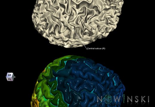 G9.T7.3.DualImageSulci.Central sulcus right