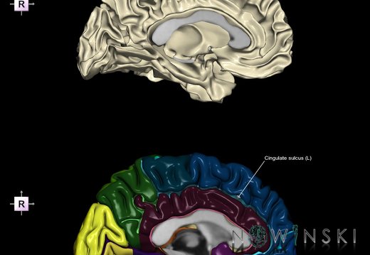 G9.T7.4.DualImageSulci.Cingulate sulcus left