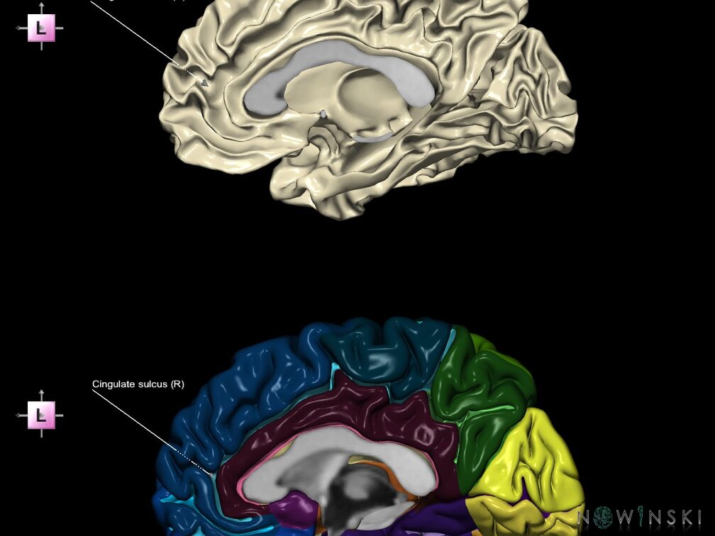 G9.T7.4.DualImageSulci.Cingulate sulcus right