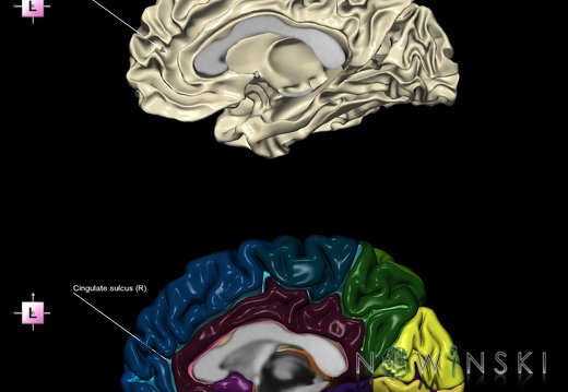G9.T7.4.DualImageSulci.Cingulate sulcus right