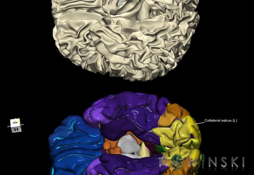 G9.T7.5.DualImageSulci.Collateral sulcus left