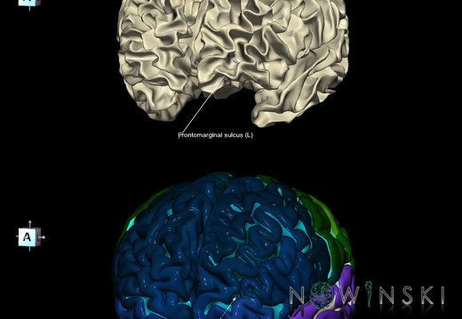 G9.T7.6.DualImageSulci.Frontomarginal sulcus left