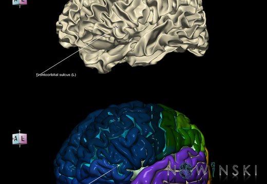 G9.T7.7.DualImageSulci.Frontoorbital sulcus left