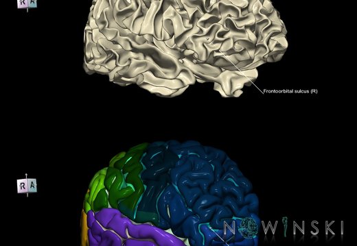 G9.T7.7.DualImageSulci.Frontoorbital sulcus right