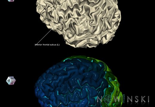 G9.T7.8.DualImageSulci.Inferior frontal sulcus left