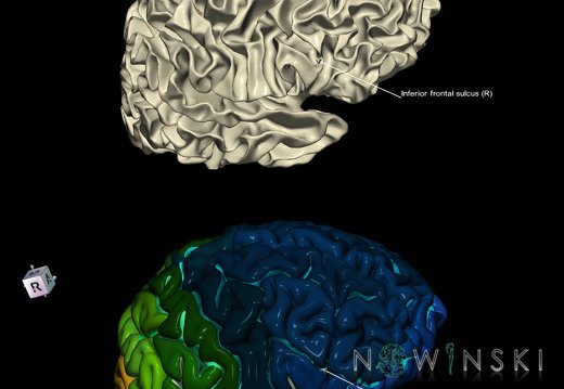 G9.T7.8.DualImageSulci.Inferior frontal sulcus right