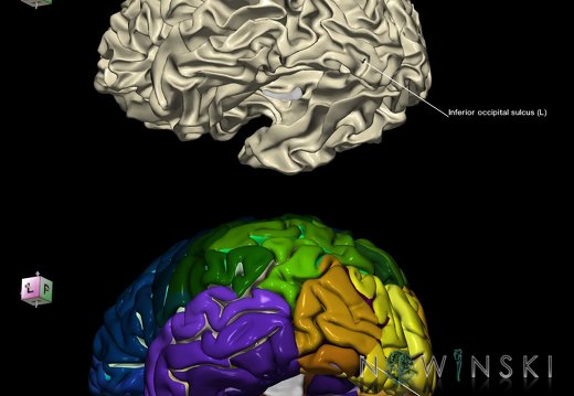 G9.T7.9.DualImageSulci.Inferior occipital sulcus left