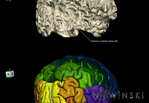 G9.T7.9.DualImageSulci.Inferior occipital sulcus right
